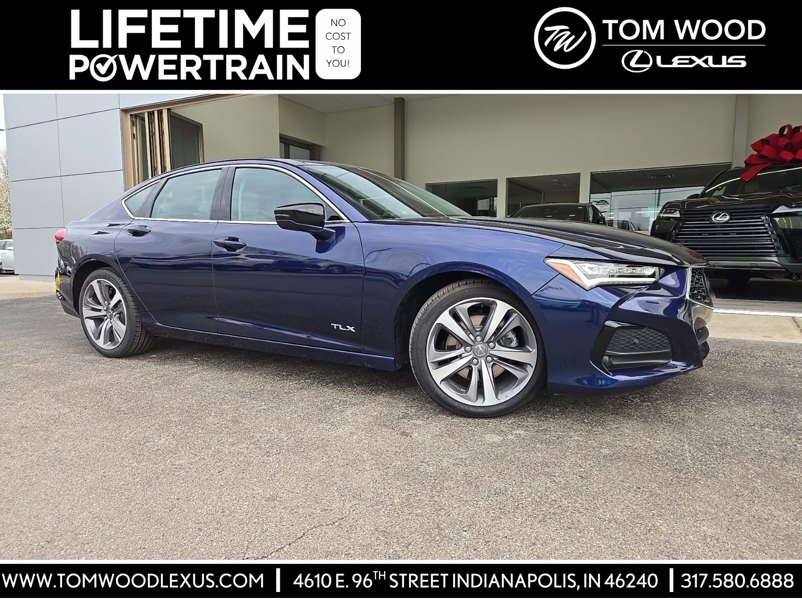 2021 Acura TLX SH-AWD with Advance Package